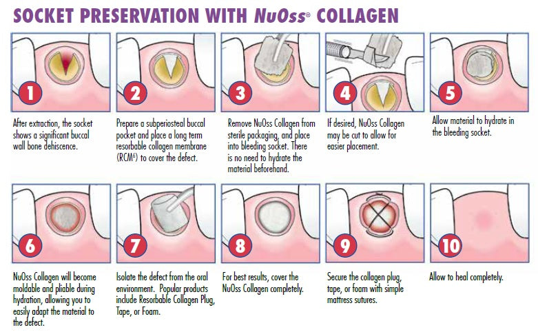 NuOss コラーゲン