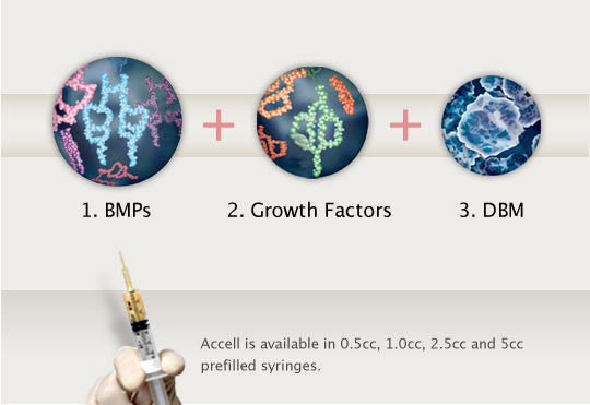 Accell Connexus DBM Bone Graft Substitute With BMPs 0.5cc