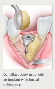 DynaBlast パテ 2.5cc