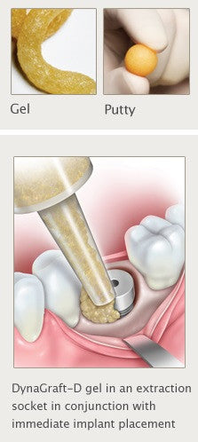 DynaGraft - D ジェル 1.0cc
