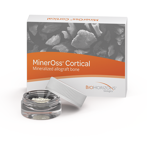 MinerOss FDBA Cortical 1.0cc