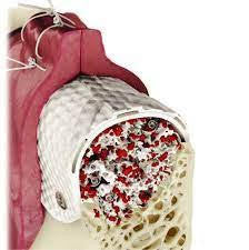 CYTOPLAST TXT - 200 シングルズ (12 x 24mm) 10枚入