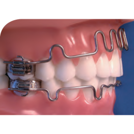 Lip Bumper Lower Large