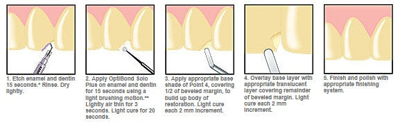 Point 4 Syringe Refill - A3.5 1本入り