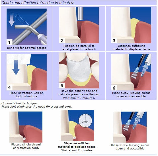 トラキシオデント ヘモデント ぺースト スターター パック Traxodent Hemodent Paste Starter Pack