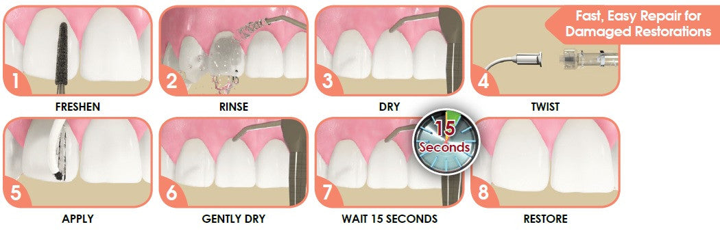 ファースト フィックス ポーセレン リペーアー イントロ キット FastFix Porcelain Repair Intro Kit